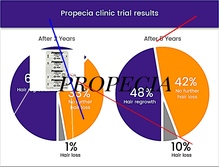 Propecia ou acheter